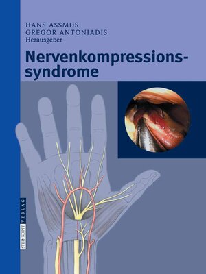 cover image of Nervenkompressionssyndrome
